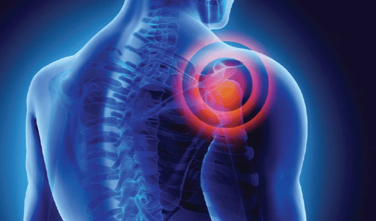 shoulder pain shoulder pain
